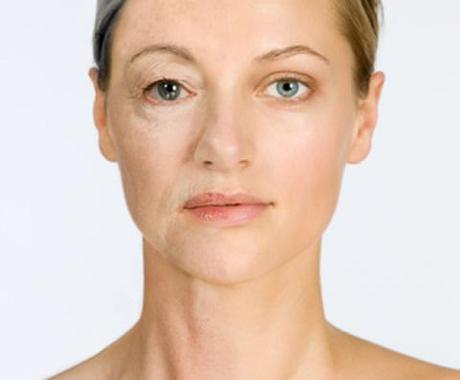 RESTAURA TU PIEL CON EL ÁCIDO HIALURÓNICO