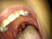 ¿Cuál diagnóstico?