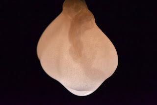 Un Riñón de Laboratorio Que Produce Orina en Ratones