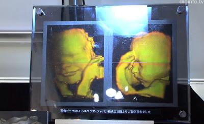 Nueva tecnología para ver hologramas 3D a través de ultrasonido