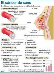 Angelina Jolie revela que se sometió a una doble mastectomía Angelina Jolie revela que se sometió a una doble mastectomía