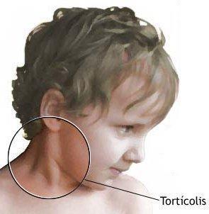 Lesiones I - Las cuatro lesiones más frecuentes