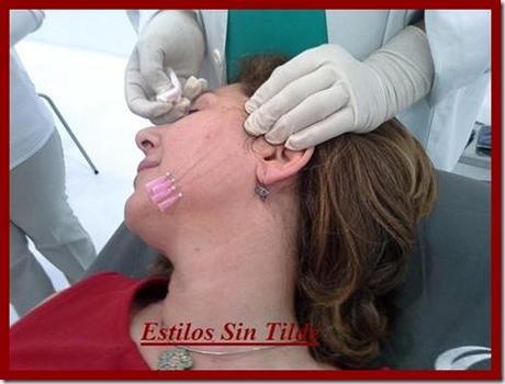 Reafirma tu piel con los “hilos mágicos” fotonoticia 20130517153409 510 thumb Reafirma tu piel con los hilos mágicos