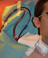 Memoria de mi Enfermera XLVII: «Con un golpe se me estropeó la Fístula»