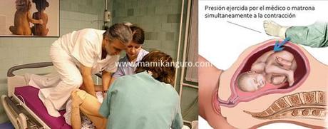 Maniobra Kristeller y violencia obstétrica kristeller