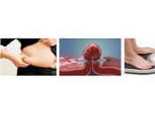 Primeros resultados Método Pose largo plazo