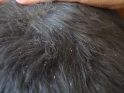 El perro con alergia alimentaria (intolerancia) Despues-Caspa 600