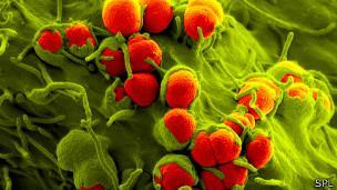 (658) LA GONORREA CERCA DE NO SER TRATABLE