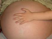 deficiencia yodo embarazo puede afectar cociente intelectual bebés