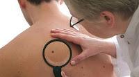LA PIEL  PUEDE AVISAR DE  LA PRESENCIA DE UN CANCER INTERNO