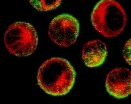 Descubren el mecanismo exacto que confiere a un fármaco su propiedad anticáncer Descubren el mecanismo exacto que confiere a un fármaco su propiedad anticáncer