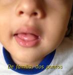 Enfermedad Mano – Pie – Boca