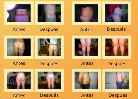 TRATAMIENTOS ESPECIALES PARA EL VERANO II. TRATAMIENTOS ESPECIALES PARA EL VERANO II.