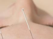 Curación mediante Acupuntura