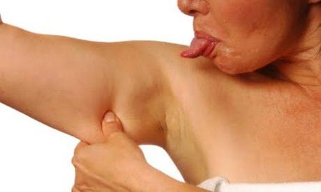 Tengo flacidez en los brazos Tengo flacidez en los brazos