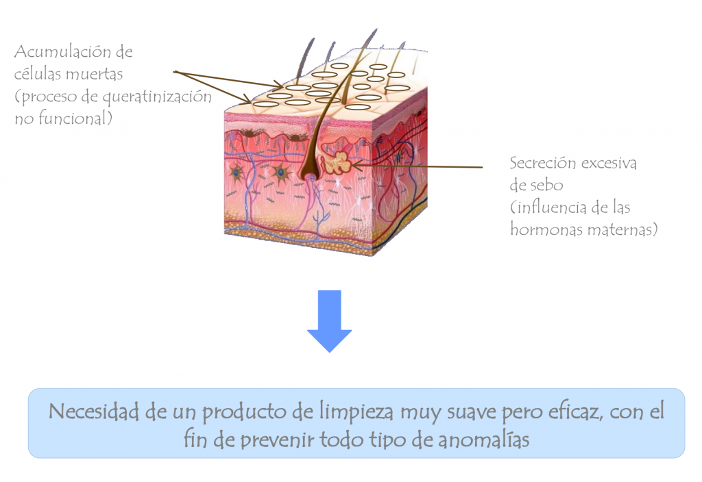 Piel con costra láctea