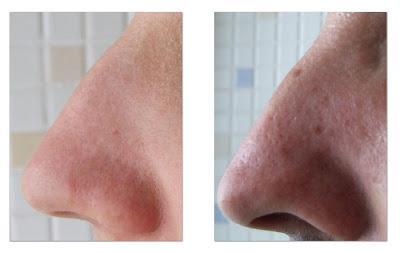 “Pore Beauty Nose Pack” de SKINMISO – un tratamiento para poros de WISHTREND (From Asia With Love)