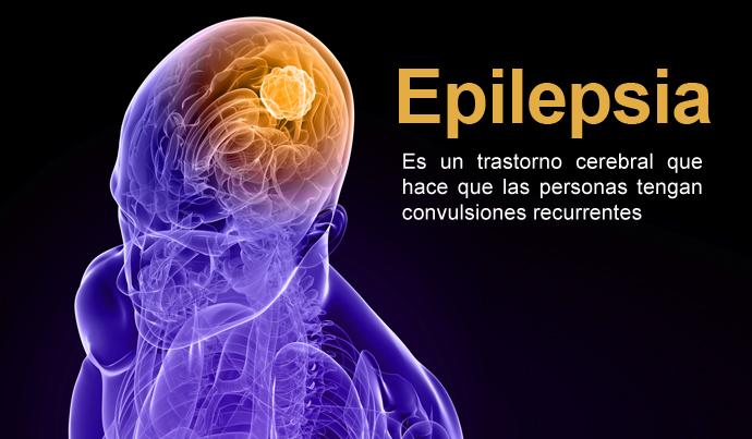 ¿Qué hacer ante un ataque epiléptico?