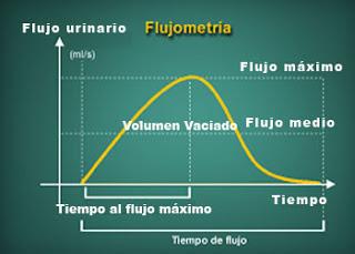 ¿Qué es una flujometría miccional?