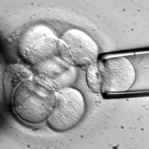 Investigación con células madre embrionarias