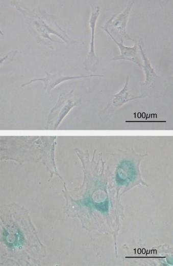 Las células Antiguas dejan su senescencia a las Nuevas