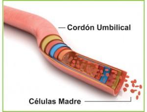 Cordon Umbilical