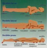 Guía práctica clínica en prevención de úlceras por presión