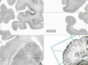 Conozca Google Earth' cerebro humano
