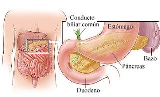 pancreatitis