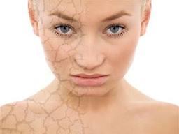 rostro2 Las preguntas más frecuentes en la consulta de un dermatólogo