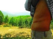 Órganos Trasplantan Mundo Proceden Tráfico ilegal