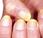 color forma uñas ayudan diagnosticar ciertas enfermedades