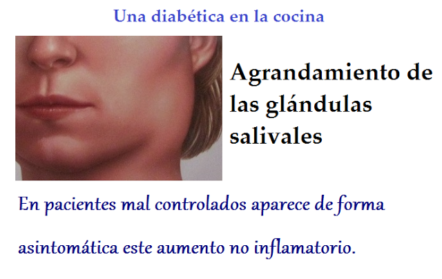 La diabetes y la salud bucodental