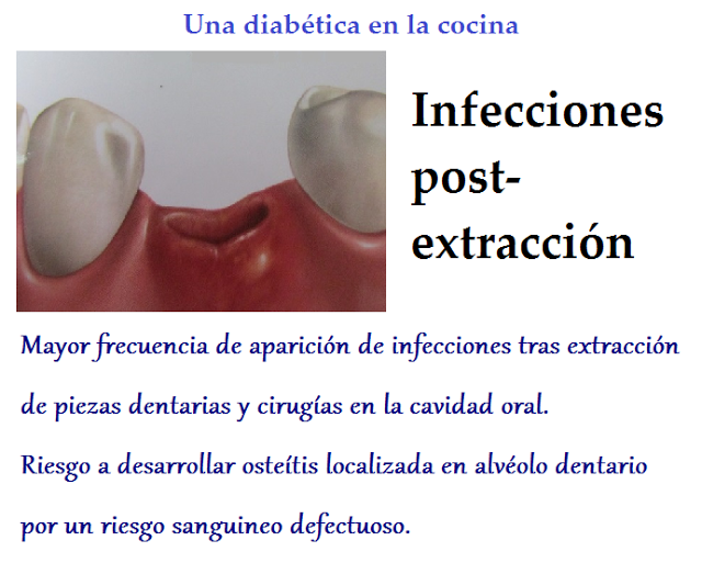La diabetes y la salud bucodental