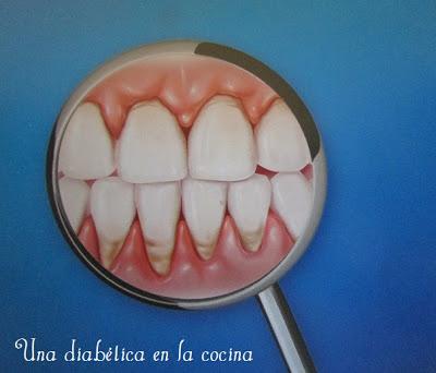 La diabetes y la salud bucodental