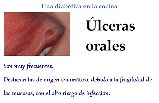 La diabetes y la salud bucodental