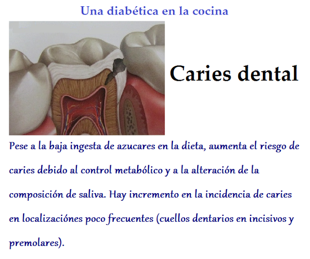 La diabetes y la salud bucodental