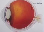 edema macular daibético (EMD)