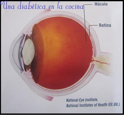 El edema macular daibético (EMD)