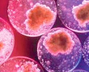 BROTES  DE HÍGADO HUMANO CON CÉLULAS MADRE iPS