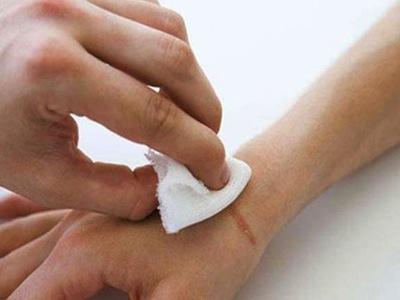 Consejos tratar heridas infectadas