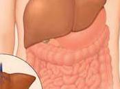 hepatitis