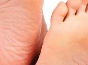 Beneficios pasar tiempo descalzo