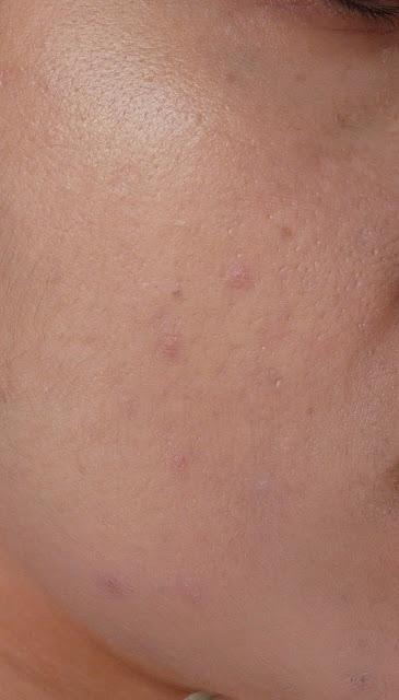 Descubriendo Skin79 con Mery Sintacones