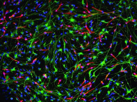 (PDF) Neurogénesis en el cerebro adulto