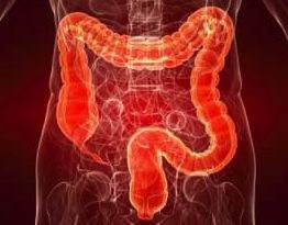 Consejos para prevenir el cáncer de colon