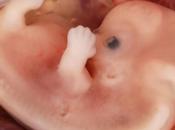 dieta rica ácido fólico infancia, altera marcadores genéticos obesidad