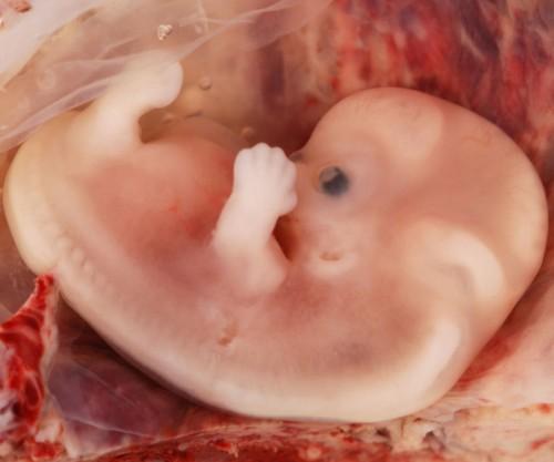 Suplementación con ácido fólico