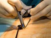 Seis preguntas clave para salir vivo cirugía