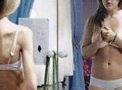 Peligros laxantes para bajar peso